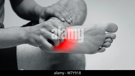 Uomo di graffiare il prurito sul suo piede con eruzione cutanea rossa Foto Stock