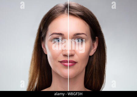 Close-up di un giovane volto di donna prima e dopo la procedura di personalizzazione Foto Stock