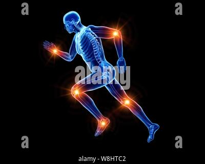 Runner con dolore articolare, concettuale illustrazione del computer. Foto Stock