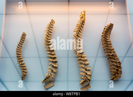 Modello di una colonna vertebrale umana, colonne vertebrali Foto Stock