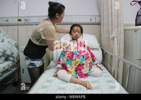 12-anno-vecchia ragazza Han Bingbing, destra, che soffre di un tumore gigante nel suo ventre è frequentato da sua madre al cancro Fuda ospedale nella città di Guangzhou, Foto Stock