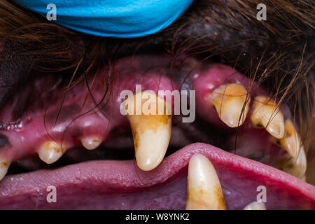 Close-up foto di denti di innesto con la placca batterica o tartaro Foto Stock