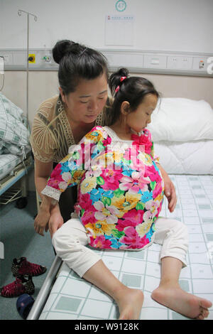 12-anno-vecchia ragazza Han Bingbing, destra, che soffre di un tumore gigante nel suo ventre è frequentato da sua madre al cancro Fuda ospedale nella città di Guangzhou, Foto Stock