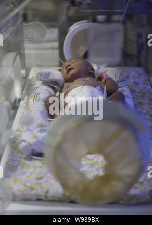 Il bambino abbandonato è raffigurato in una unità di terapia intensiva neonatale in Foshan cura materna e infantile Centro di Servizio in Foshan, sudest Chinas Guangdon Foto Stock