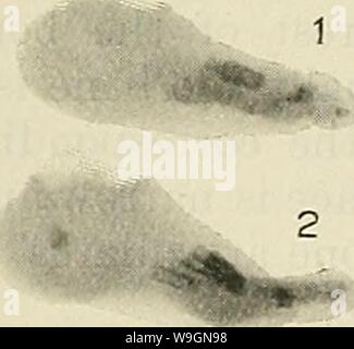 Immagine di archivio da pagina 297 di Cunningham il libro di testo di anatomia (1914). Cunningham il libro di testo di anatomia cunninghamstextb00cunn Anno: 1914 ( la tuberosità scanalatura per peroxeus longus una scanalatura per peron.-eus tuberosità longus il suo centro e in prossimità del suo bordo dorsale. Questo è per l'articolazione con il lato laterale del terzo cuneiforme ; prossimale e distale rispetto a questa superficie è ruvida per legamenti. Non di rado, prossimale alla faccetta per il terzo cuneiforme, vi è una piccola superficie articolare per la navicular, come avviene normalmente in il gorilla, mentre in direzione prossimale e sul plantare un Foto Stock