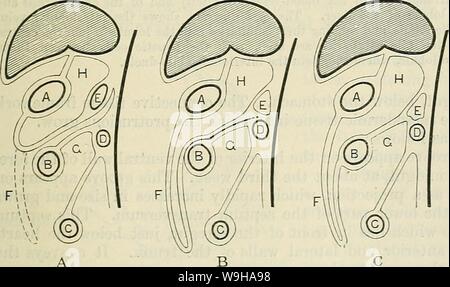 Immagine di archivio da pagina 1286 di Cunningham il libro di testo di anatomia (1914). Cunningham il libro di testo di anatomia cunninghamstextb00cunn Anno: 1914 ( il mesenterio retto del mesenterio di colon discendente Fig. 974.-due diagrammi per illustrare lo sviluppo del Mesenteries. Nella prima figura la rotazione dell'ansa intestinale e il continuo mesenterio primitivo è mostrato. Nella seconda figura (a destra), che mostra una fase più avanzata, le porzioni della primitiva mesenterica (passando per l'ascendente e discendente i due punti) che dis- appaiono, attraverso la loro adesione alla parte posteriore abdomina Foto Stock