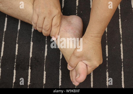 Il trattamento di lesioni ai piedi e gamba con la pressione di un dito dal massaggio tradizionale tailandese . Foto Stock