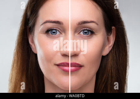 Close-up di un giovane volto di donna prima e dopo la procedura di personalizzazione Foto Stock