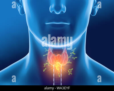 Dal punto di vista medico 3D illustrazione che mostra gli anticorpi di attaccare la ghiandola tiroidea di un uomo. Foto Stock