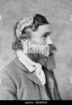 Robert McGee, scalped dal Capo Sioux piccola tartaruga marina nel 1864. Robert McGee, testa e spalle ritratto, rivolto verso destra che mostra gli effetti di essere scalped come un bambino. 1890 Foto Stock