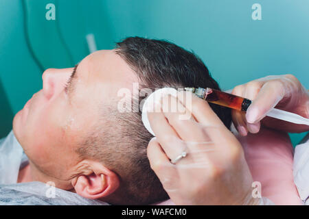 Trattamento della calvizie con iniezioni di bellezza. Cosmetologo mani guanti nel fare una iniezione sottocutanea. Plasmalifting paziente di sesso maschile Foto Stock