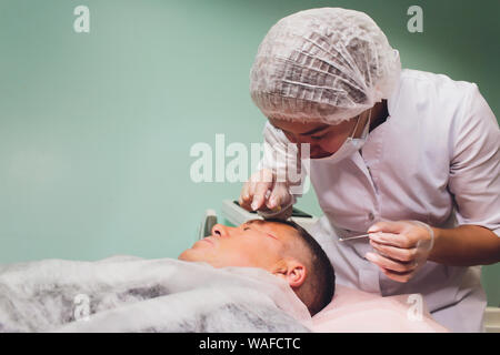 Close-up di procedura per il face lifting DOP operazione di sutura, face lifting chirurgia. tecnica innovativa di filo nuovo ascensore, NovaThreads e Silhouette Foto Stock