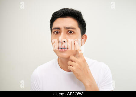 Chiudere la foto del giovane uomo cercando acnes sul suo volto Foto Stock