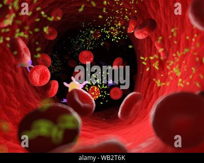I batteri in un vaso sanguigno, illustrazione del computer. Foto Stock
