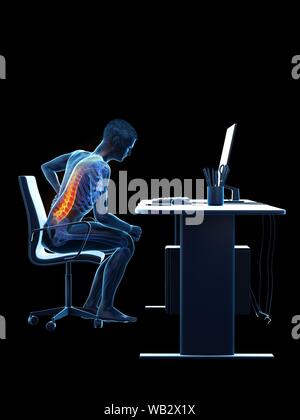 Dolore alla schiena a causa di seduta, illustrazione concettuale. Foto Stock