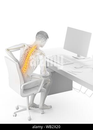 Dolore alla schiena a causa di seduta, illustrazione concettuale. Foto Stock
