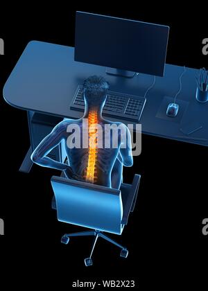 Dolore alla schiena a causa di seduta, illustrazione concettuale. Foto Stock