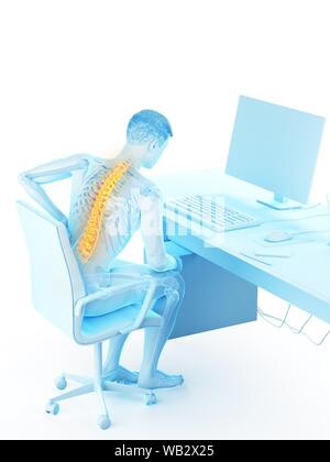 Dolore alla schiena a causa di seduta, illustrazione concettuale. Foto Stock