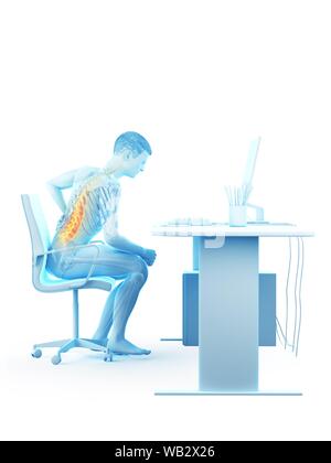 Dolore alla schiena a causa di seduta, illustrazione concettuale. Foto Stock
