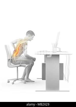 Dolore alla schiena a causa di seduta, illustrazione concettuale. Foto Stock