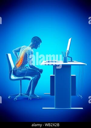 Dolore alla schiena a causa di seduta, illustrazione concettuale. Foto Stock