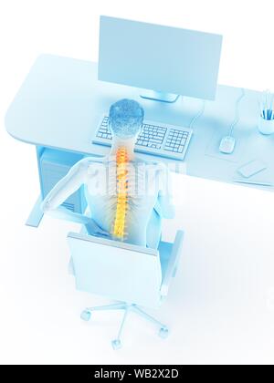 Dolore alla schiena a causa di seduta, illustrazione concettuale. Foto Stock