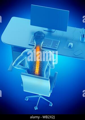 Dolore alla schiena a causa di seduta, illustrazione concettuale. Foto Stock