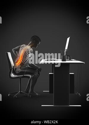 Dolore alla schiena a causa di seduta, illustrazione concettuale. Foto Stock