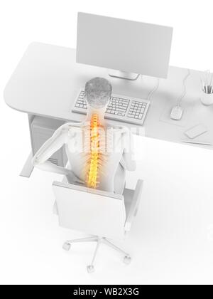Dolore alla schiena a causa di seduta, illustrazione concettuale. Foto Stock