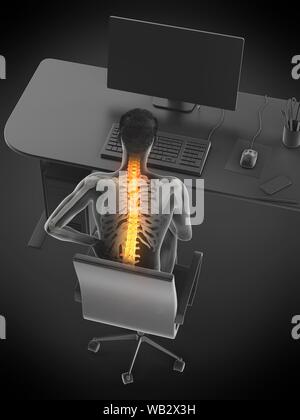 Dolore alla schiena a causa di seduta, illustrazione concettuale. Foto Stock