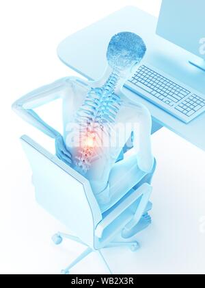 Dolore alla schiena a causa di seduta, illustrazione concettuale. Foto Stock