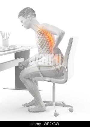 Dolore alla schiena a causa di seduta, illustrazione concettuale. Foto Stock