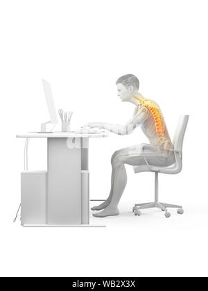 Dolore alla schiena a causa di seduta, illustrazione concettuale. Foto Stock