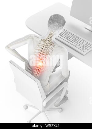 Dolore alla schiena a causa di seduta, illustrazione concettuale. Foto Stock