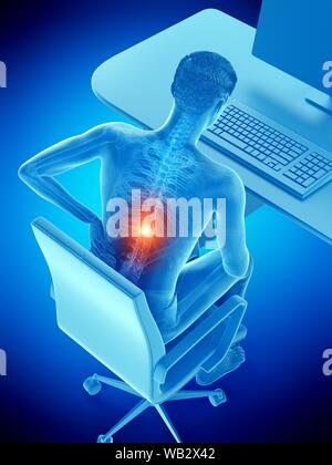 Dolore alla schiena a causa di seduta, illustrazione concettuale. Foto Stock