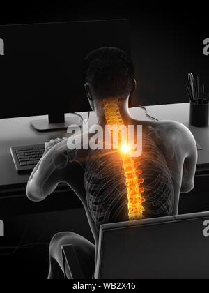 Dolore alla schiena a causa di seduta, illustrazione concettuale. Foto Stock