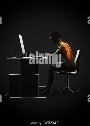 Dolore alla schiena a causa di seduta, illustrazione concettuale. Foto Stock