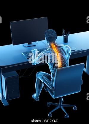 Dolore alla schiena a causa di seduta, illustrazione concettuale. Foto Stock