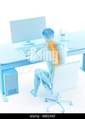 Dolore alla schiena a causa di seduta, illustrazione concettuale. Foto Stock