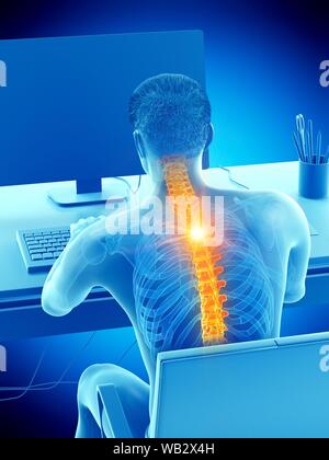 Dolore alla schiena a causa di seduta, illustrazione concettuale. Foto Stock