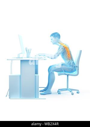 Dolore alla schiena a causa di seduta, illustrazione concettuale. Foto Stock