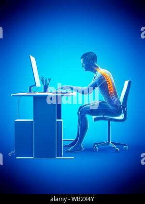 Dolore alla schiena a causa di seduta, illustrazione concettuale. Foto Stock