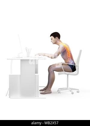 Dolore alla schiena a causa di seduta, illustrazione concettuale. Foto Stock