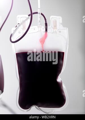 Il sangue del donatore di elaborazione. Il donatore il sangue viene separato nei suoi componenti. Foto Stock
