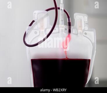 Il sangue del donatore di elaborazione. Il donatore il sangue viene separato nei suoi componenti. Foto Stock