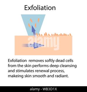 Esfoliazione o Peeling, illustrazione di vettore isolato su sfondo bianco con le frecce Illustrazione Vettoriale