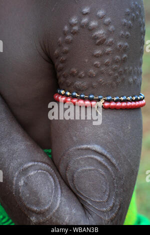 Scarificazione sulla parte superiore del corpo, tribù Mursi, bassa valle dell'Omo, Etiopia Foto Stock