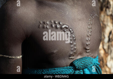 Scarificazione sulla parte superiore del corpo, tribù Mursi, bassa valle dell'Omo, Etiopia Foto Stock