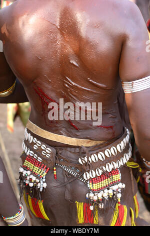 Scarificazione sulla parte superiore del corpo, tribù Mursi, bassa valle dell'Omo, Etiopia Foto Stock