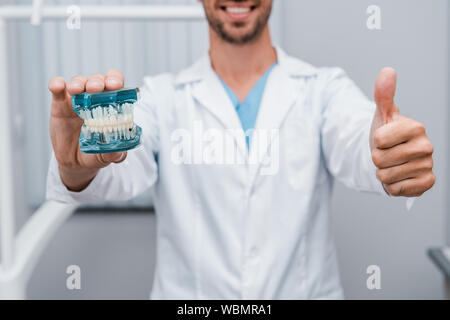 Vista ritagliata del barbuto dentista che mantiene i denti modello e mostrando il pollice in alto Foto Stock